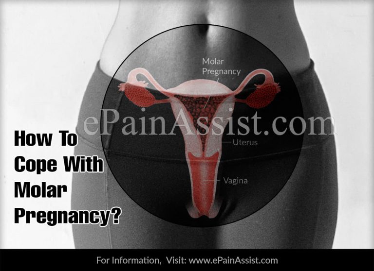 How To Cope With Molar Pregnancy?