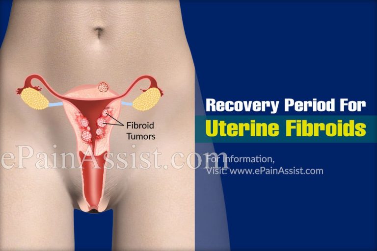 Recovery Period For Uterine Fibroids