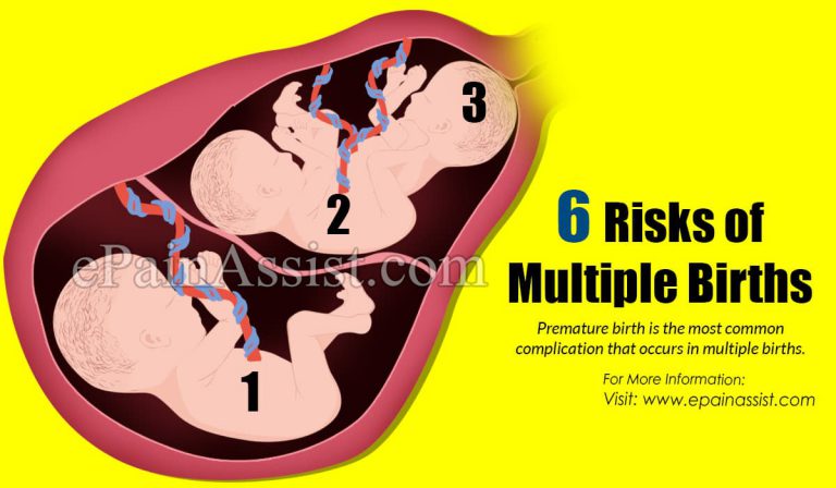 6 Risks of Multiple Births & How is the Pregnancy with Multiple Births Managed?