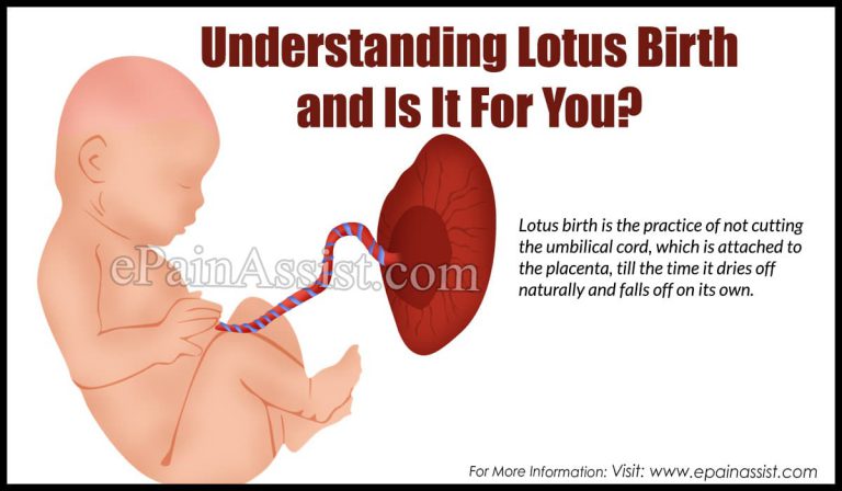 Understanding Lotus Birth and Is It For You?
