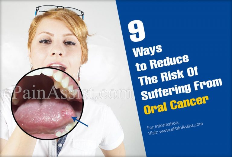 9 Ways to Reduce The Risk Of Suffering From Oral Cancer