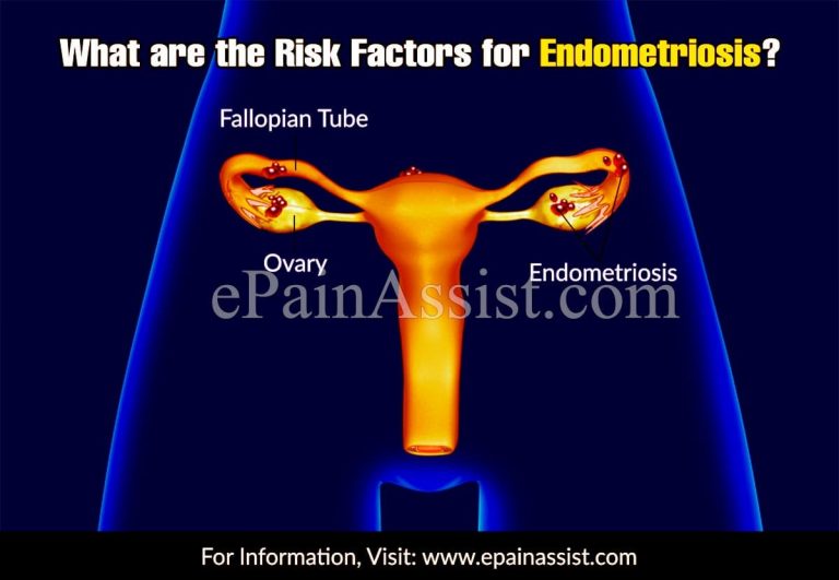 What are the Risk Factors for Endometriosis?