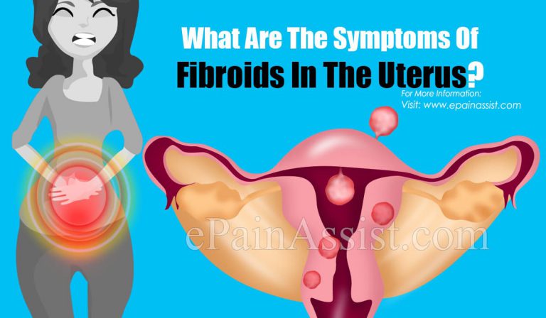 What Are The Symptoms Of Fibroids In The Uterus?