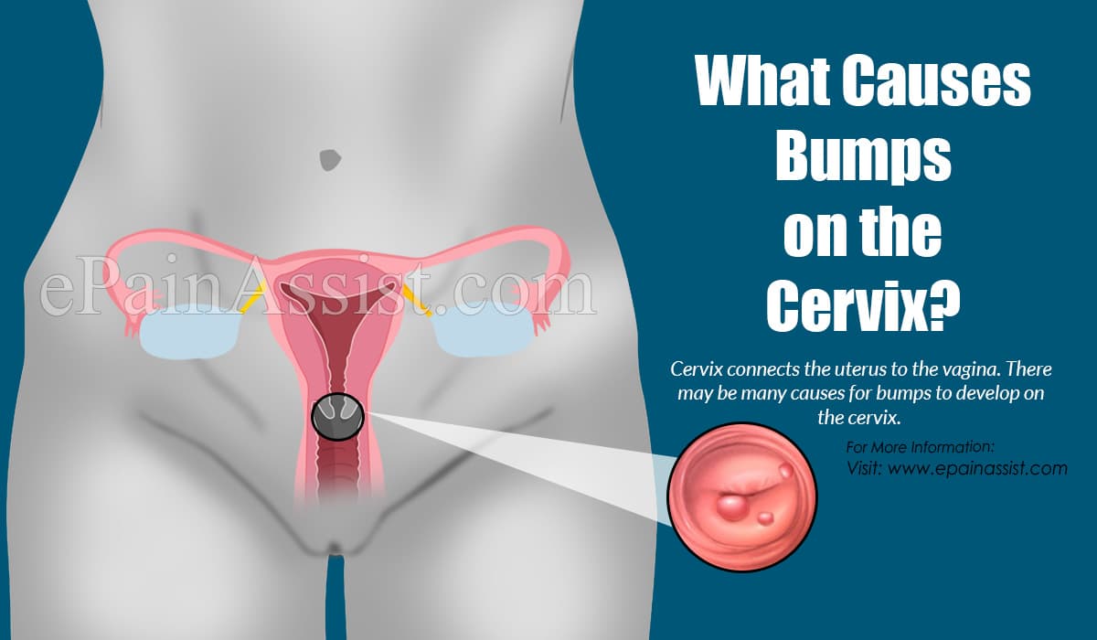 What Causes Bumps on the Cervix?