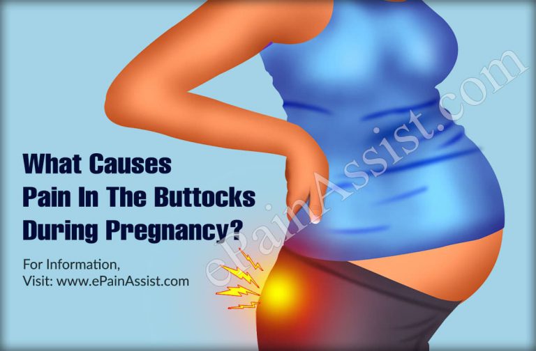 What Causes Pain in the Buttocks During Pregnancy and Home Remedies To Treat It?