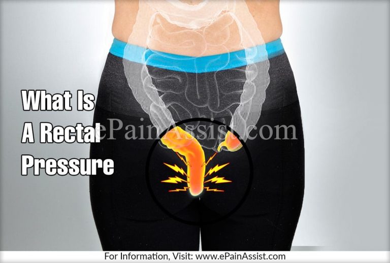 Rectal Pressure: Causes & Treatment