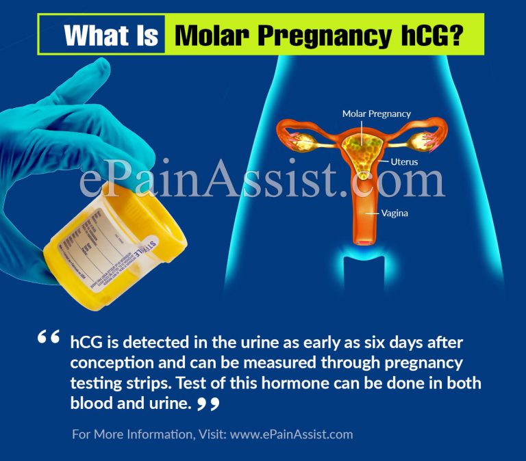 What Is Molar Pregnancy hCG?