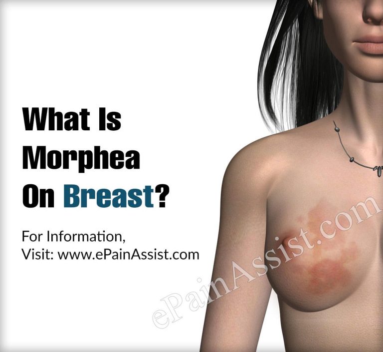 What Is Morphea On Breast?