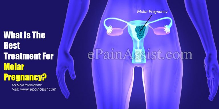 What Is The Best Treatment For Molar Pregnancy?
