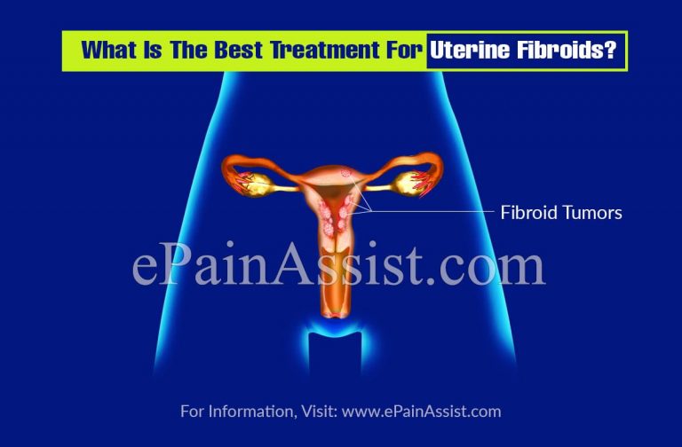 What Is The Best Treatment For Uterine Fibroids?