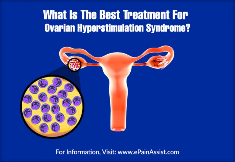 What Is The Best Treatment For Ovarian Hyperstimulation Syndrome?