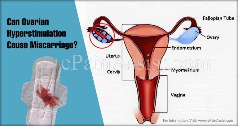 Can Ovarian Hyperstimulation Cause Miscarriage?