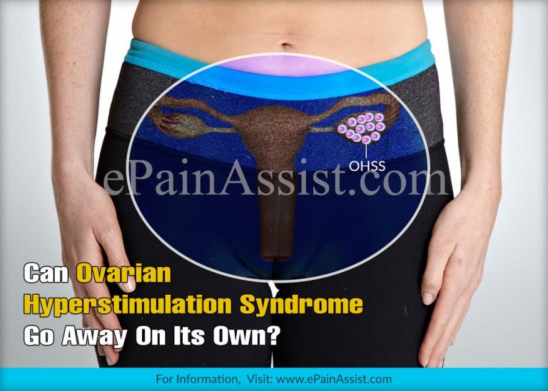Can Ovarian Hyperstimulation Syndrome Go Away On Its Own & What Are Its Natural Remedies?