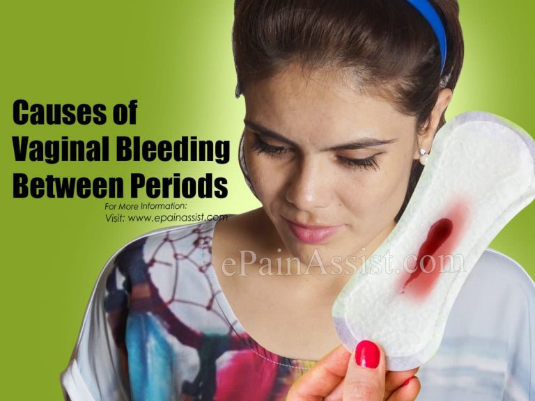 Causes of Vaginal Bleeding Between Periods