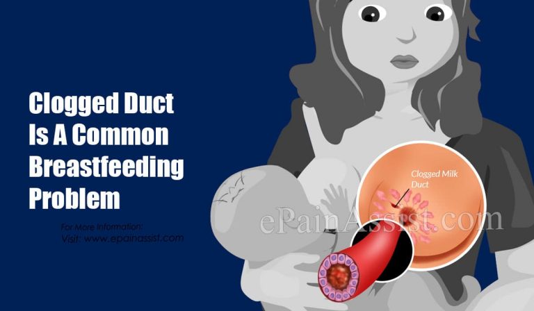 Clogged Duct Is A Common Breastfeeding Problem