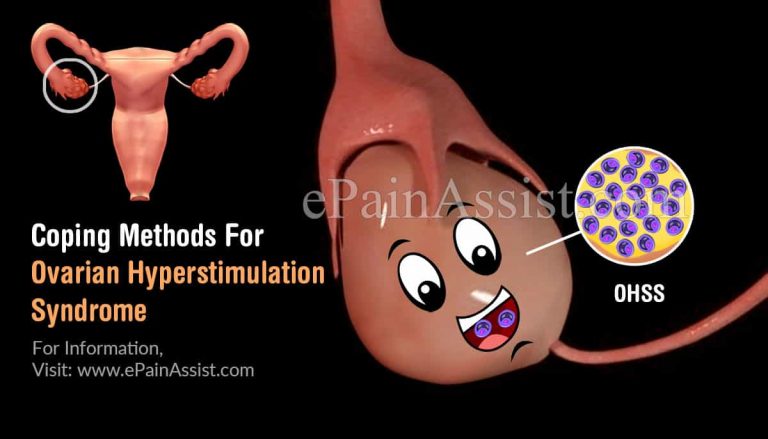 Coping Methods For Ovarian Hyperstimulation Syndrome