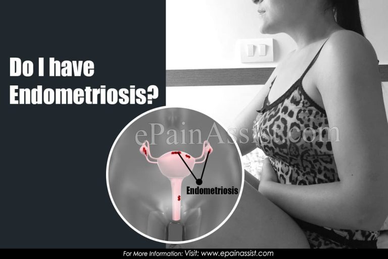 Do I Have Endometriosis & What are the Top Signs That Indicate Endometriosis?