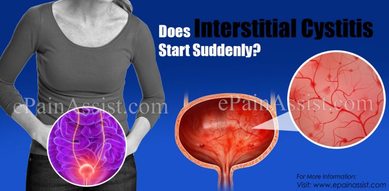 Does Interstitial Cystitis Start Suddenly & Can It Be Sexually Transmitted?