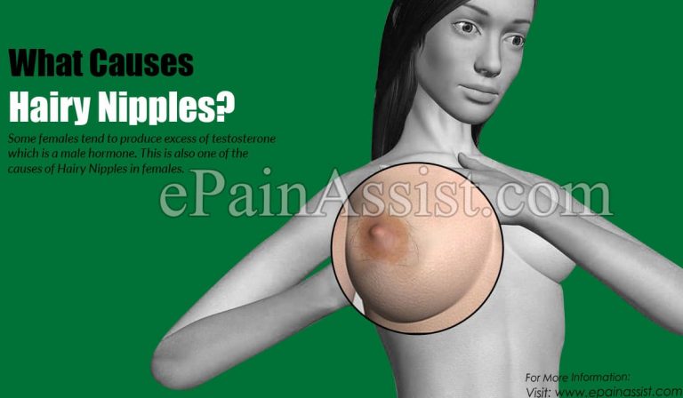 Hairy Nipples: Causes & Treatment