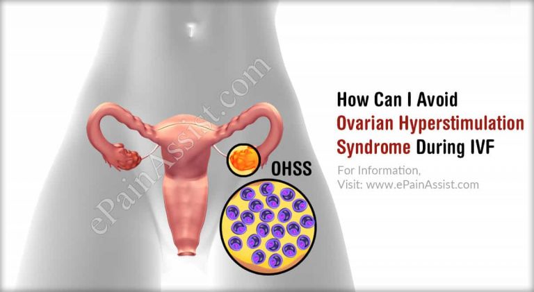 How Can I Avoid Ovarian Hyperstimulation Syndrome During IVF & How Is Mild OHSS Treated?