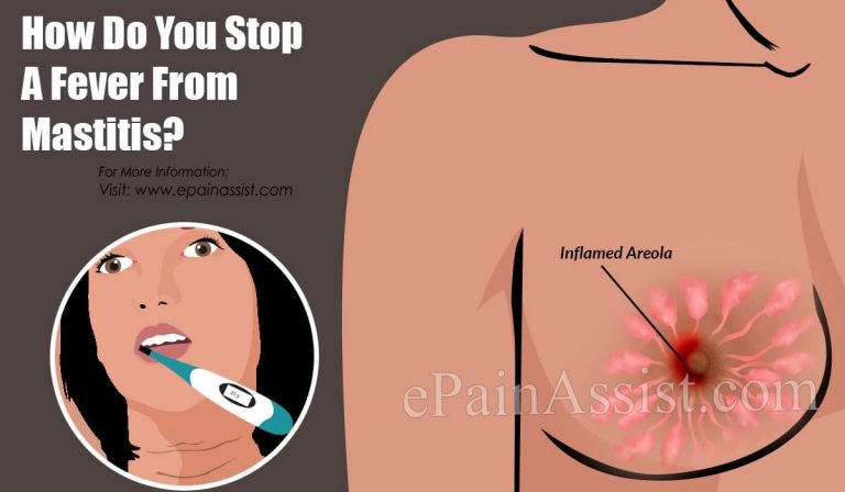 How Do You Stop A Fever From Mastitis?