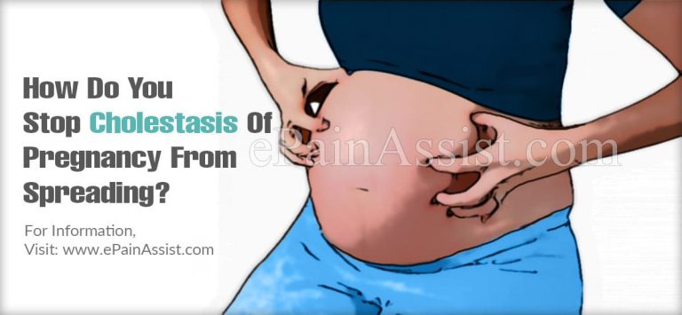 How Do You Stop Cholestasis Of Pregnancy From Spreading?