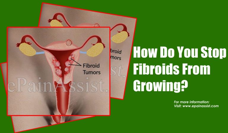 How Do You Stop Fibroids From Growing?