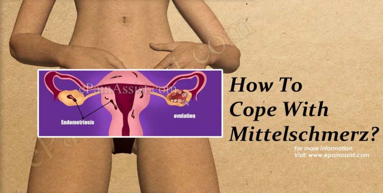 How To Cope With Mittelschmerz?