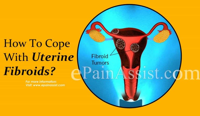 How To Cope With Uterine Fibroids?