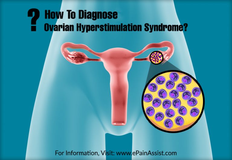 How To Diagnose Ovarian Hyperstimulation Syndrome & What Is The Best Medicine For It?