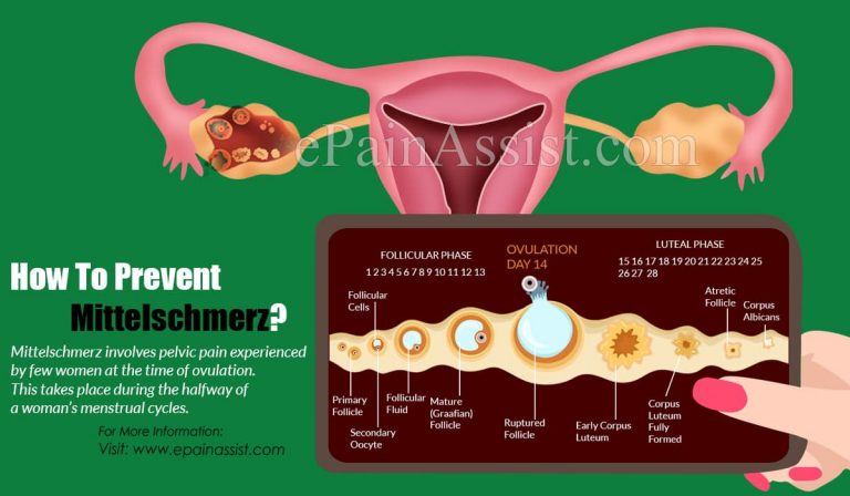 How To Prevent Mittelschmerz?