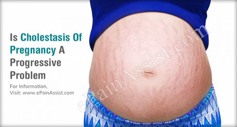 Is Cholestasis Of Pregnancy A Progressive Problem & Alternative Treatments For It?