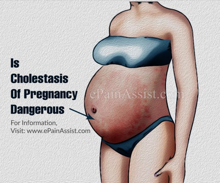 Is Cholestasis Of Pregnancy Dangerous & How Does It Affect The Baby?