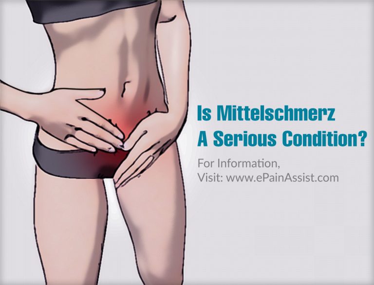 Is Mittelschmerz A Serious Condition?