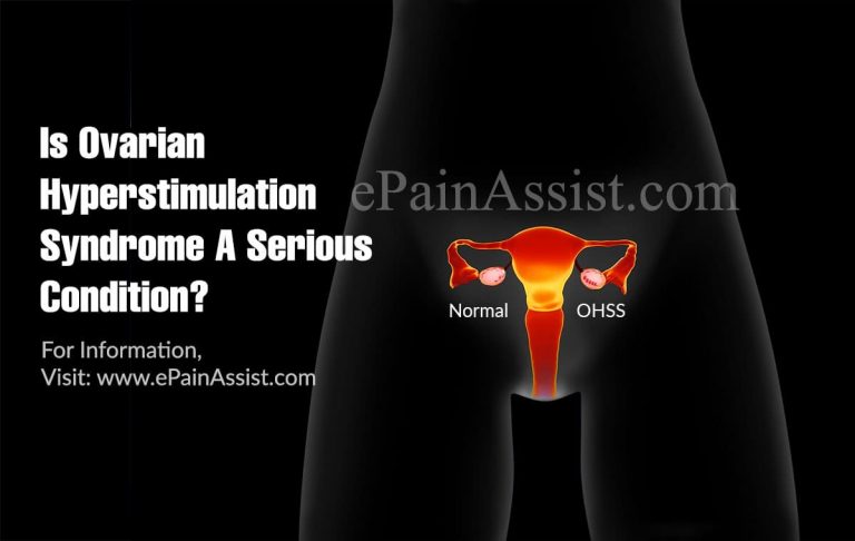 Is Ovarian Hyperstimulation Syndrome A Serious Condition & Can It Be Reversed?