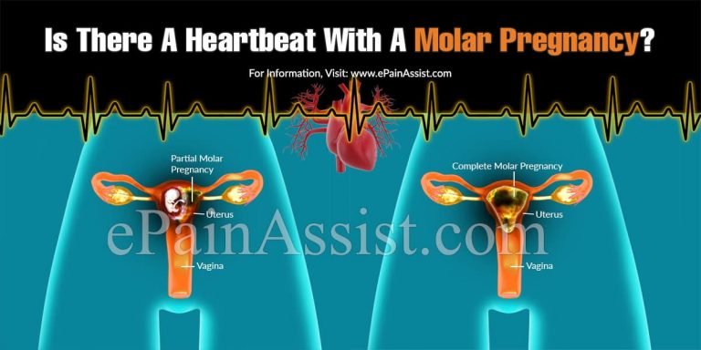 Is There A Heartbeat With A Molar Pregnancy?