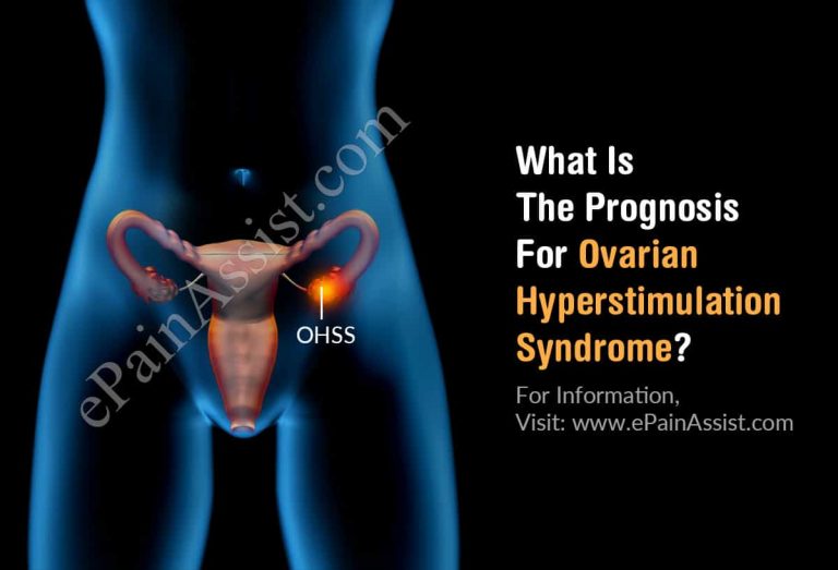 What Is The Prognosis For Ovarian Hyperstimulation Syndrome & Lifestyle Changes For it?