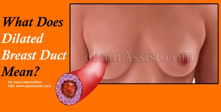 What Does Dilated Breast Duct Mean?