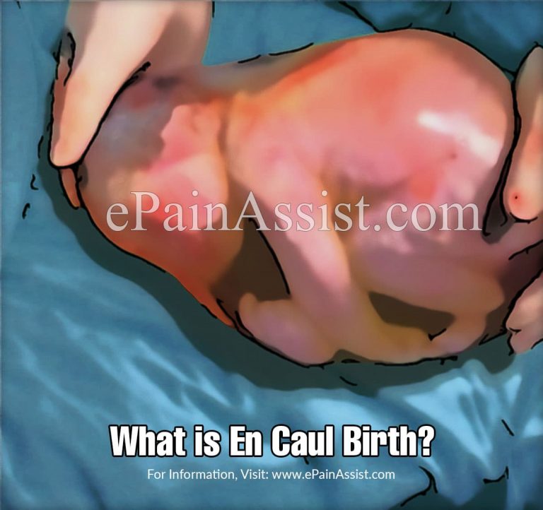 What is En Caul Birth & How is it Different From Caul Birth?