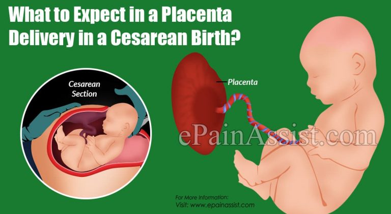 What to Expect During a Placenta Delivery in a Vaginal or a Cesarean Birth?