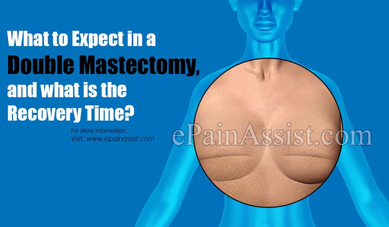 What to Expect in a Double Mastectomy, and what is the Recovery Time?