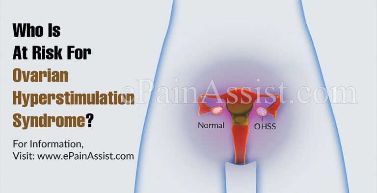 Who Is At Risk For Ovarian Hyperstimulation Syndrome & Is There A Blood Test For It?