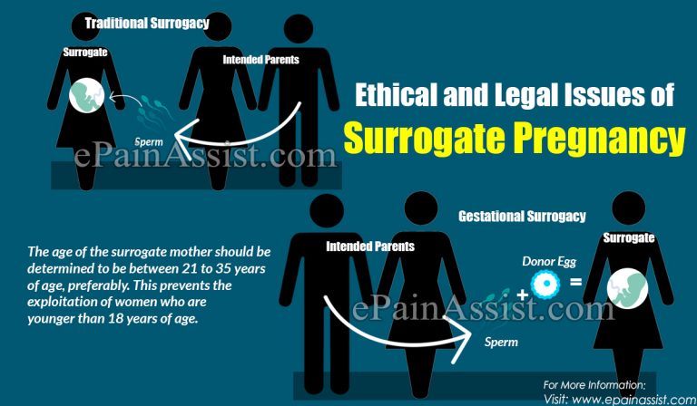 Ethical and Legal Issues of Surrogate Pregnancy