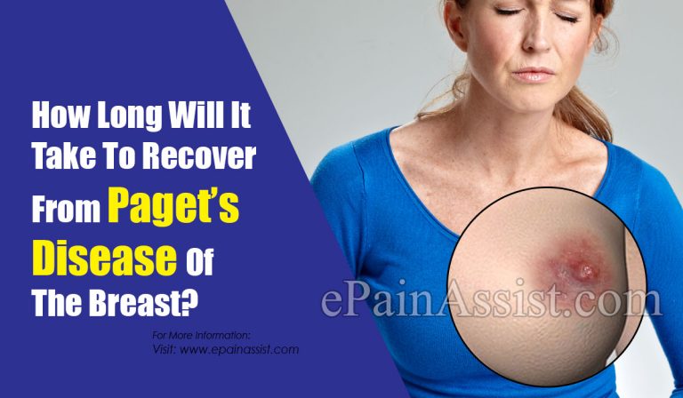 How Long Will It Take To Recover From Paget’s Disease Of The Breast? & How Long Does The Symptoms Last?