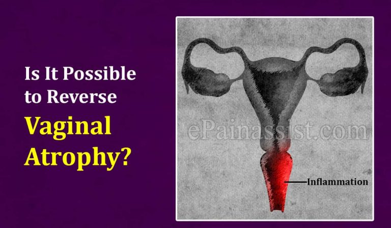 Is It Possible to Reverse Vaginal Atrophy?
