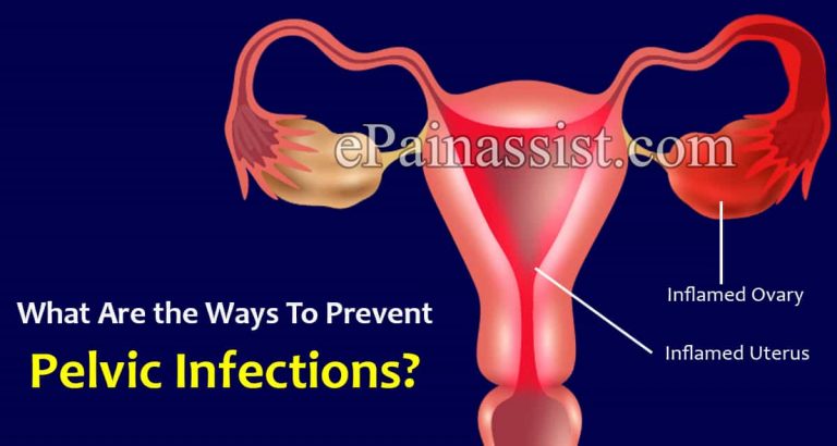 What Are The Ways To Prevent Pelvic Infections & Does It Reoccur?