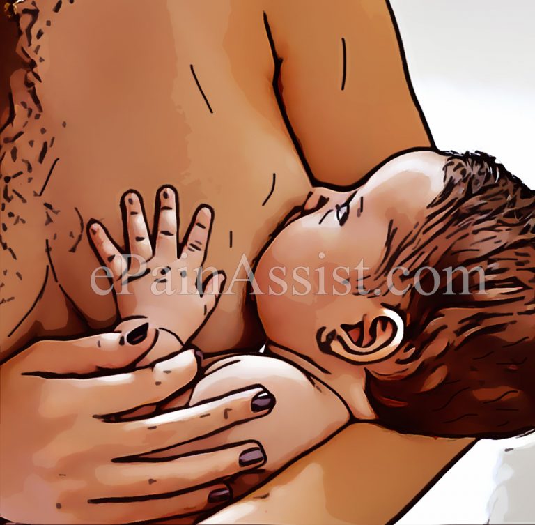 Breastfeeding and Non-Breastfeeding Causes of Bleeding Nipples