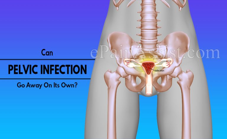Can Pelvic Infection Go Away On Its Own & What Are Its Natural Remedies?