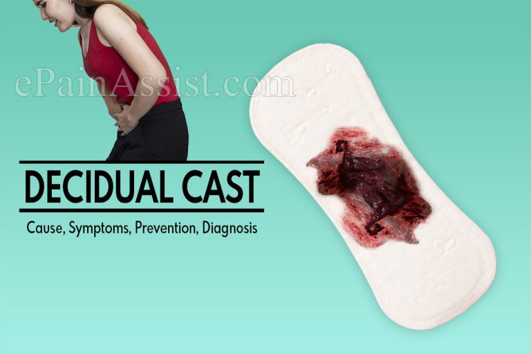 Decidual Cast: Cause, Symptoms, Prevention, Diagnosis