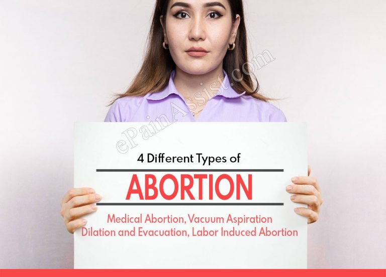 4 Different Types of Abortion